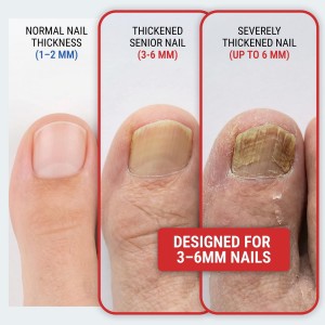 Toenail Clippers for Thick Toenails – KLIPP 15 mm Wide Jaw Thick Fingernail and Toenail Cutter with Curved Stainless-Steel Blades for Seniors (Angled Wide Opening)