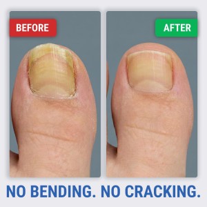 Toenail Clippers for Thick Toenails – KLIPP 15 mm Wide Jaw Thick Fingernail and Toenail Cutter with Curved Stainless-Steel Blades for Seniors (Angled Wide Opening)