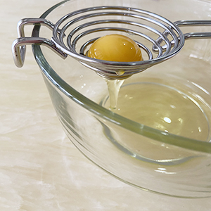 CAMKYDE Egg Separator Food Grade Stainless Steel Egg Yolk White Separation Tool, Set of 2 (Blue)