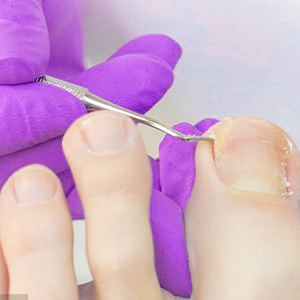 Toenail Clippers for Seniors Thick Toenails, Aucurwen Heavy Duty Toe Nail Clippers Adult Thick Nails Long Handle, Large Toenail Clippers for Thick Nails 7Pcs