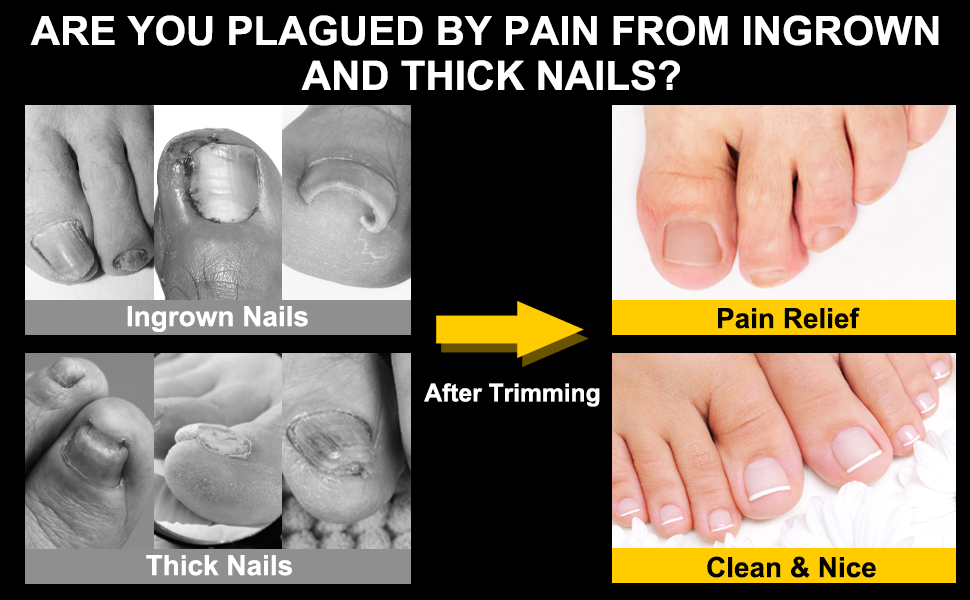 Toenail Clippers for Seniors Thick Toenails, Aucurwen Heavy Duty Toe Nail Clippers Adult Thick Nails Long Handle, Large Toenail Clippers for Thick Nails 7Pcs