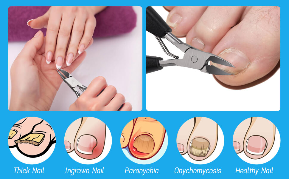 Heavy Duty Ingrown Toenail Clippers, Professional Toenails Trimmer, Podiatrist Toe Nail Clippers for Thick Nail & Ingrown Toenails, Sharp Curved Blade, Pedicure Tools.