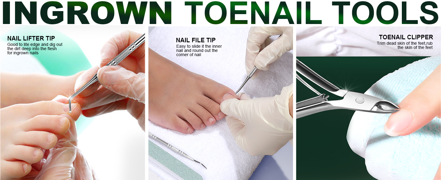 Teenitor Ingrown Toenail Tool, Pedicure Tools for Feet, Stainless Steel Ingrown Toenail Clippers, Ingrown Toenail File and Lifters