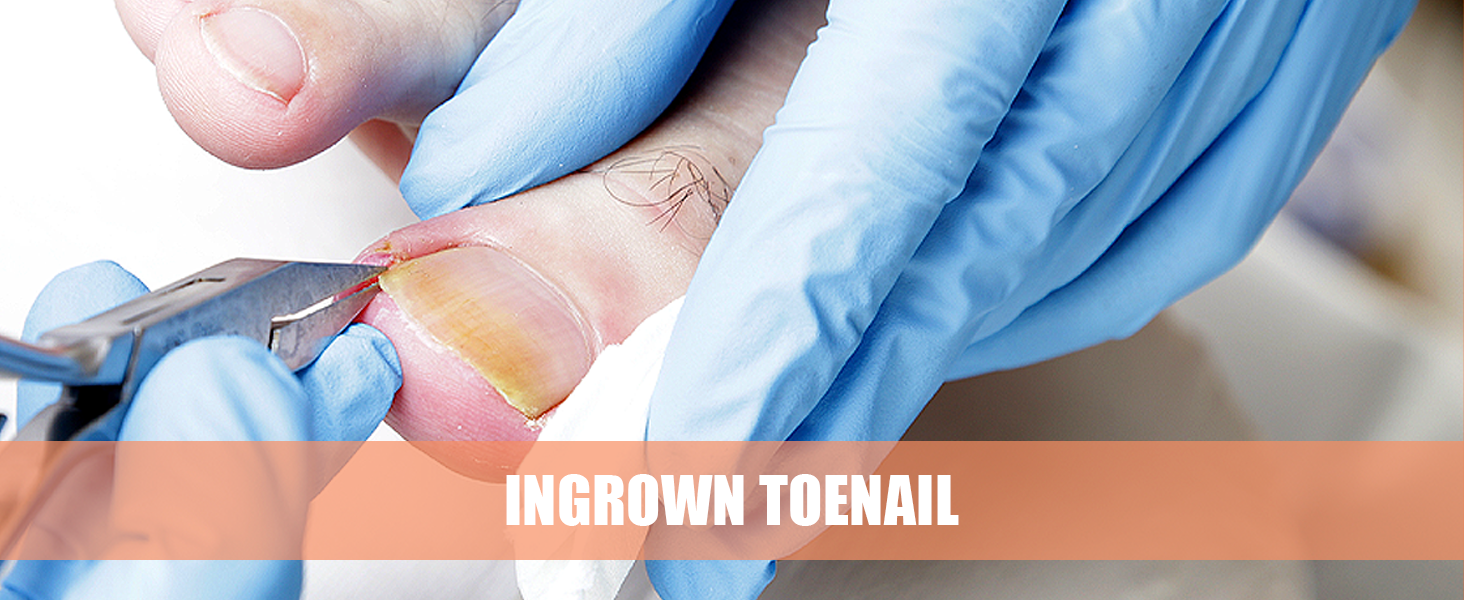 Heavy Duty Podiatrist Toenail Clippers for Thick and Ingrown Nails, Hand Forged Stainless Steel Toe Nail Clippers for Men Women Seniors