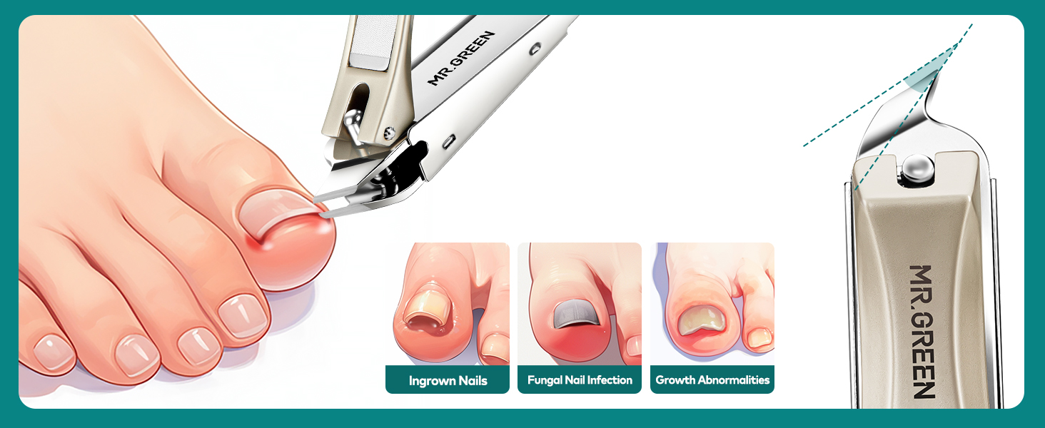 MR.GREEN 4Pcs Nail Clippers Set, Upgraded Anti-Splash Nail Clippers with Nail File and Tweezers, Professional Fingernail Toe Nail Clippers, Portable Manicure Nail Kit with Premium Case for Men& Women