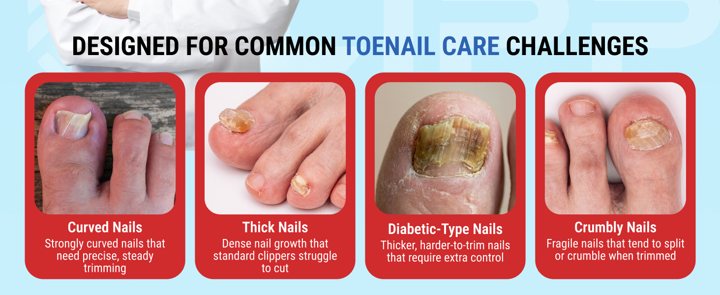 Toenail Clippers for Thick Toenails – KLIPP 15 mm Wide Jaw Thick Fingernail and Toenail Cutter with Curved Stainless-Steel Blades for Seniors (Angled Wide Opening)