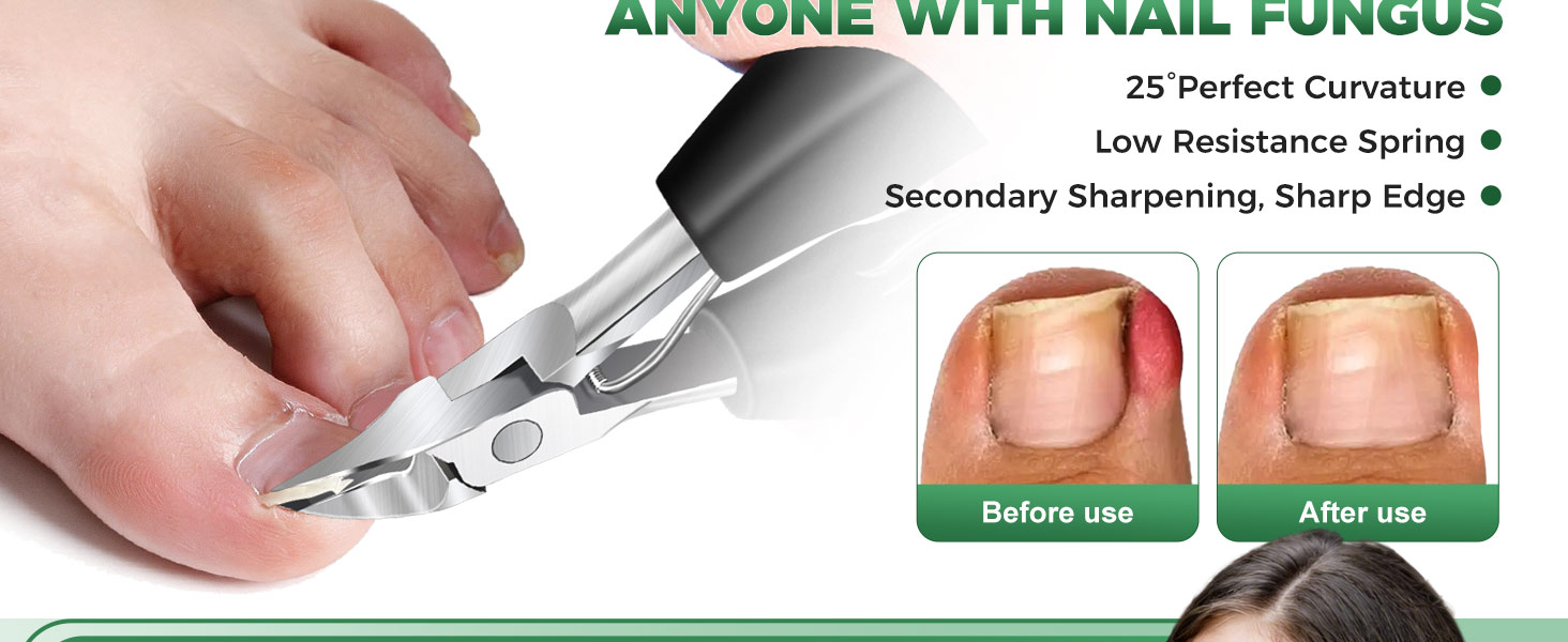 Toenail Clippers for Seniors Thick Toenails, 2026 Long Handle Toe Nail Clippers with Angled Head, Slanted Toenail Clippers & Wide Opening Ingrown Nail Clippers for Men, 6PCS