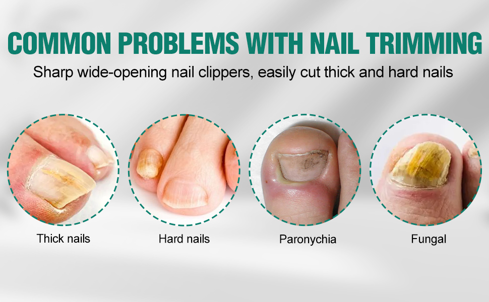 Upgraded Eagle Beak Beveled Nail Clippers, Long Handle Wide Jaw Slanted Nail Clipper, Eagle Beak Angled Edge Nail Clippers 3-Piece Set, Wide Jaw Opening Anti-Splash Nail Clipper for Men Women(Green)