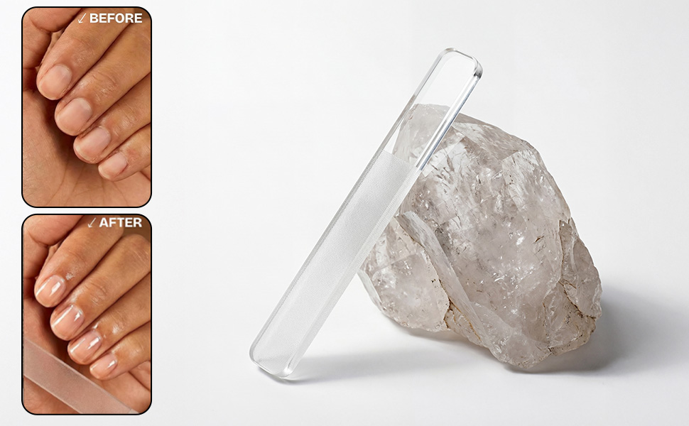 Nail Clippers Set for Men & Women, Sharp Large Opening Fingernail & Toenail Cutter, Ideal for Seniors with Thick Nails